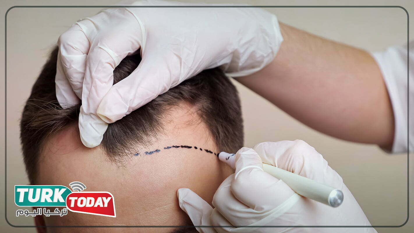 تقنية البيركوتان