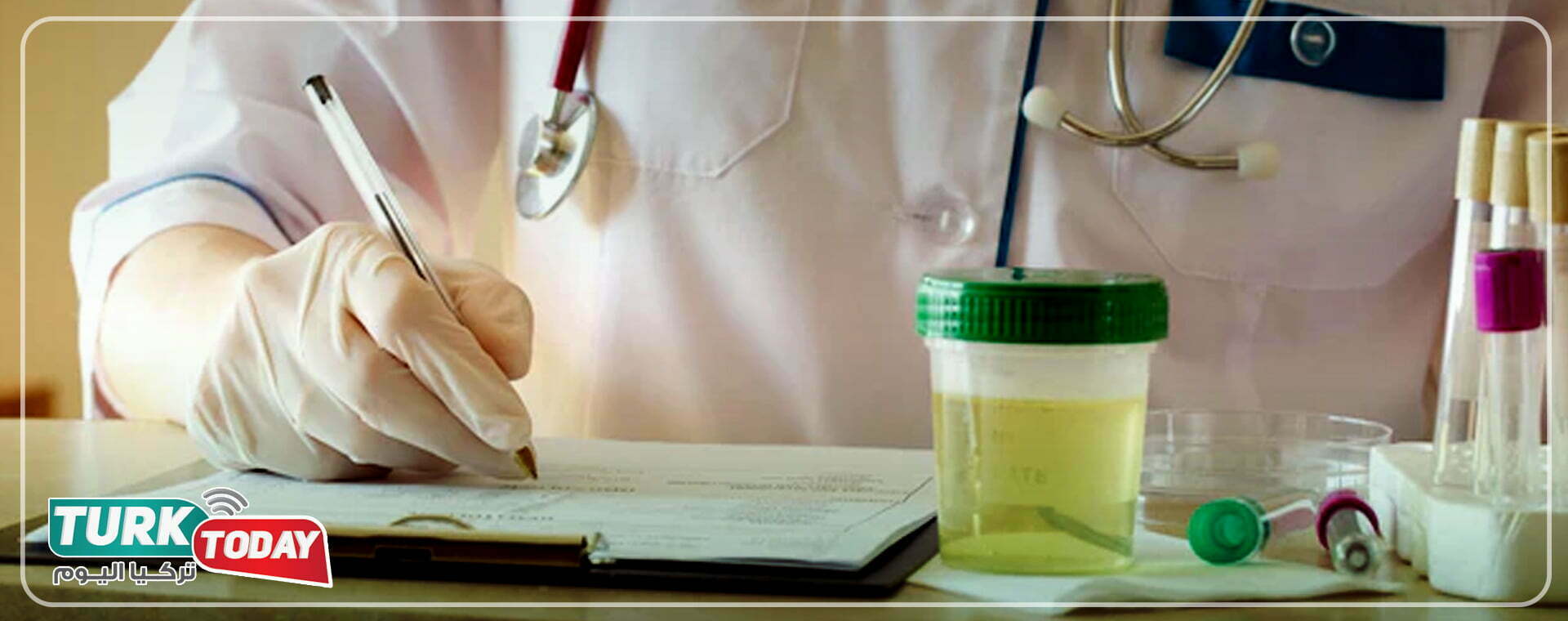 لون البول الابيض العكر