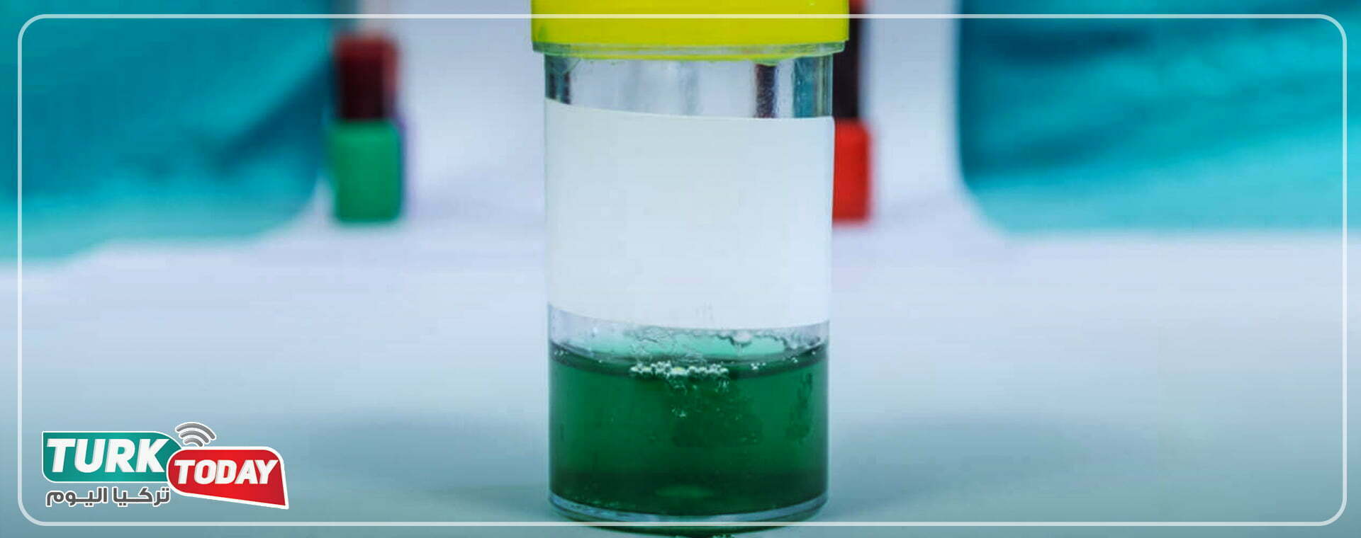 لون البول الاخضر والبول الازرق