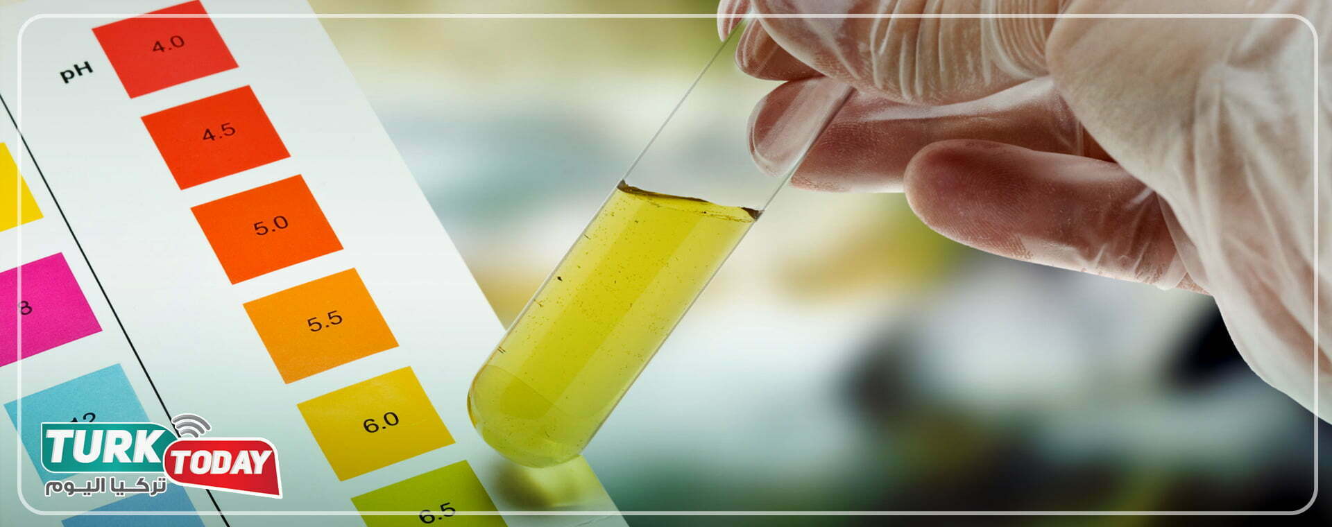 لون البول البرتقالي إلى البني