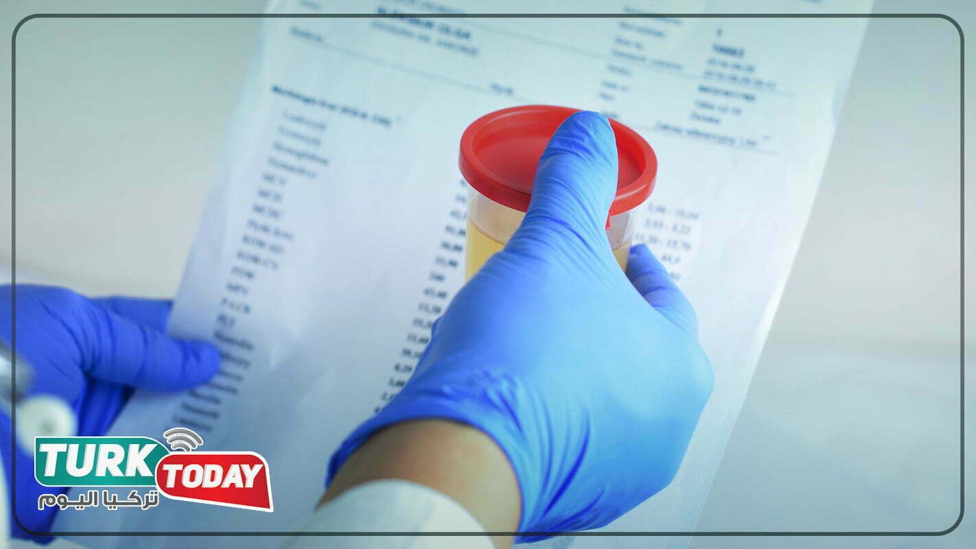 لون البول الطبيعي