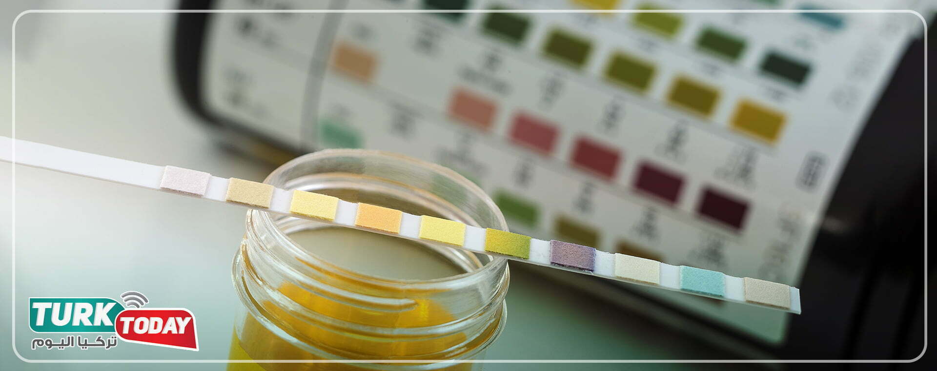 ما هي شرائط اختبار البول؟