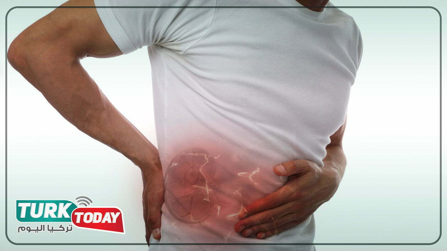 مساعدة سريعة ضد آلام الكلى